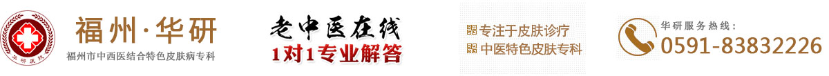 福州台江牛皮癣医院