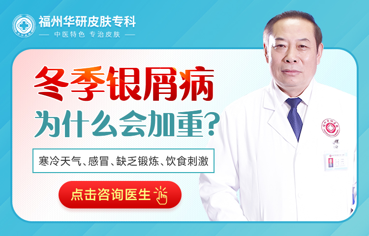 福州华研银屑病医院