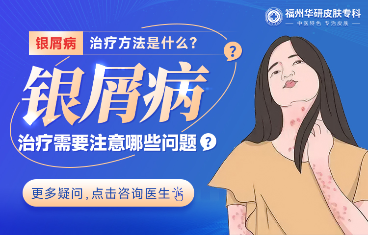 福州治疗牛皮癣去那家好