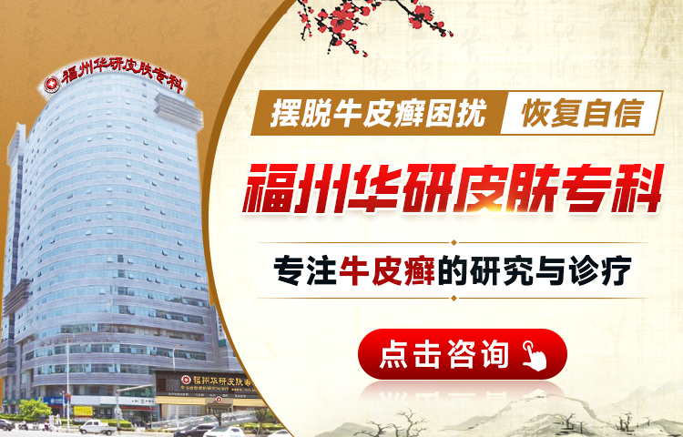 福州看皮肤病是哪家{排名汇总}福州牛皮廨治疗医院哪里好
