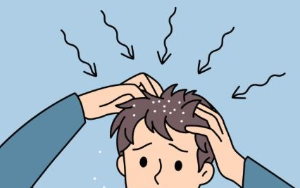 福州皮肤科专家医院:面对头癣怎么办?如何治疗头癣